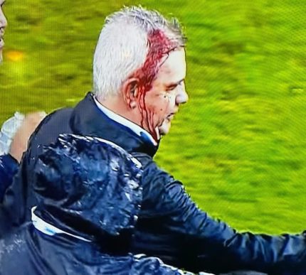 Mexico Coach Javier Aguirre Struck with Beer Can After Honduras Defeat